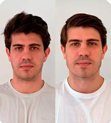 Antes e Depois