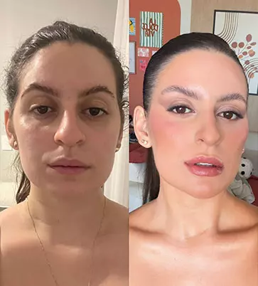 Antes e Depois